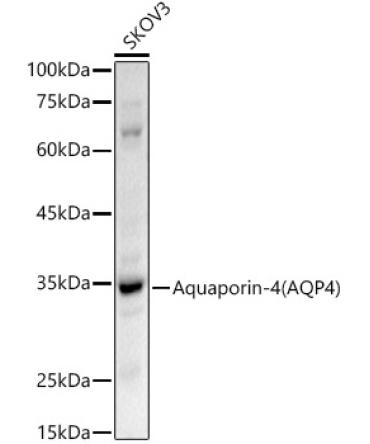 Aquaporin-4 (AQP4) Rabbit Polyclonal Antibody