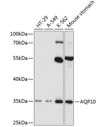AQP10 Rabbit Polyclonal Antibody