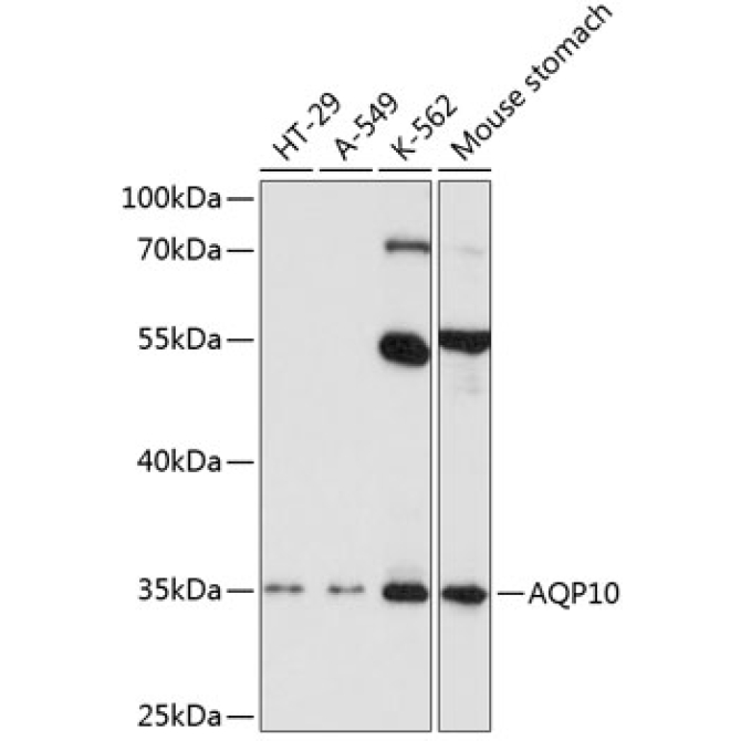 AQP10 Rabbit Polyclonal Antibody