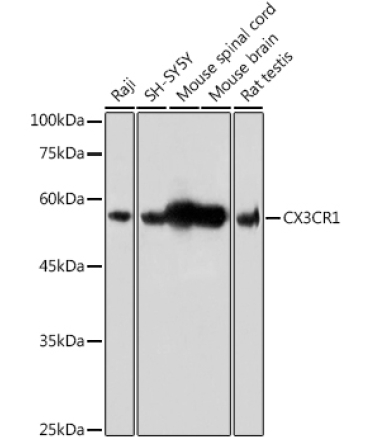 CX3CR1 Rabbit Polyclonal Antibody