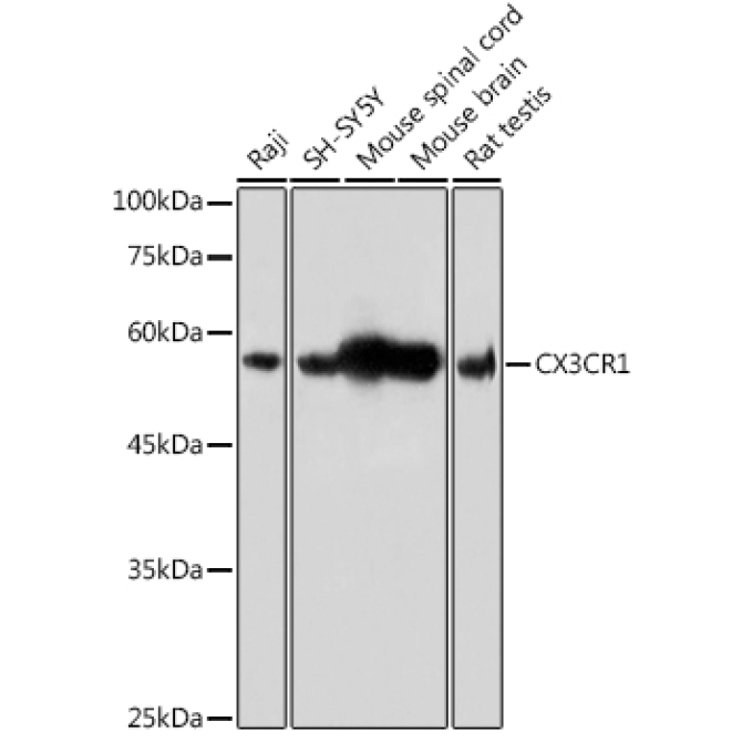 CX3CR1 Rabbit Polyclonal Antibody