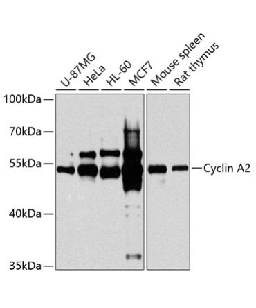 Cyclin A2 Rabbit Polyclonal Antibody