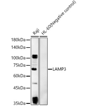 LAMP3 Rabbit Polyclonal Antibody