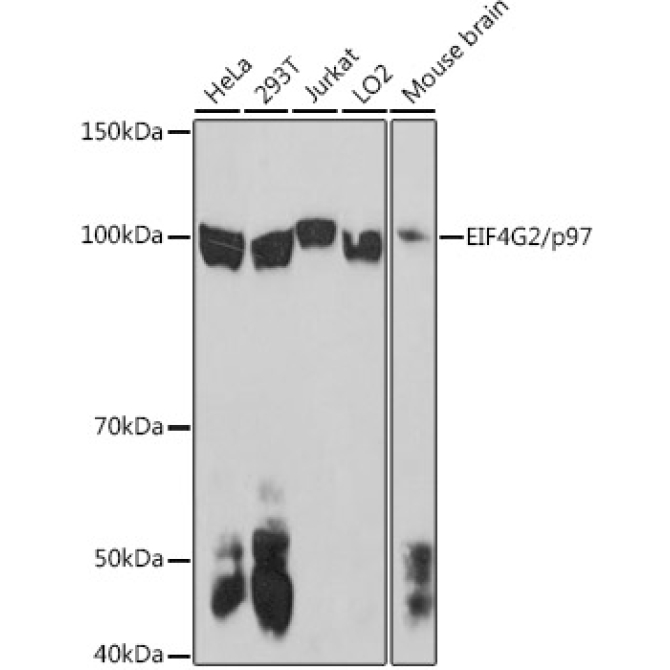 EIF4G2/p97 Rabbit Polyclonal Antibody
