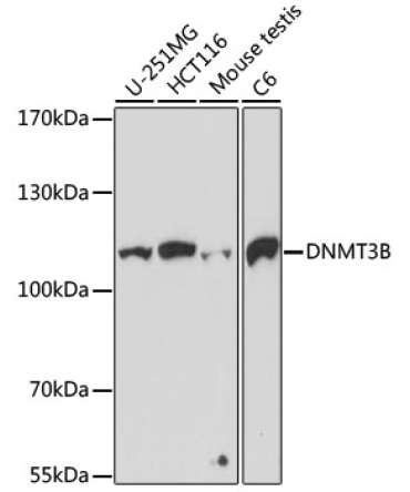 DNMT3B Rabbit Polyclonal Antibody