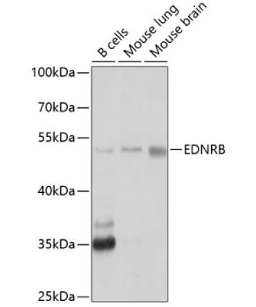 EDNRB Rabbit Polyclonal Antibody