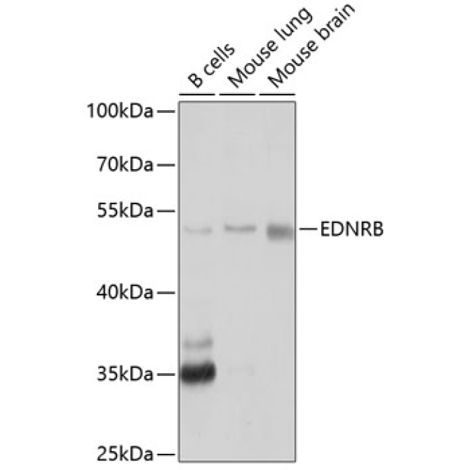 EDNRB Rabbit Polyclonal Antibody