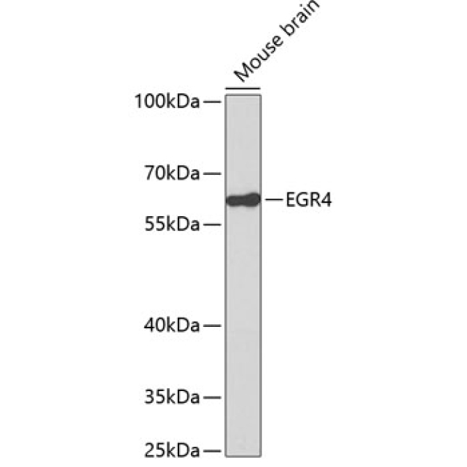 EGR4 Rabbit Polyclonal Antibody