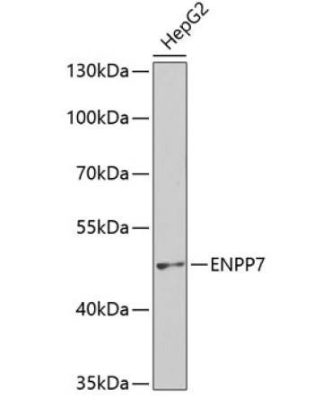 ENPP7 Rabbit Polyclonal Antibody