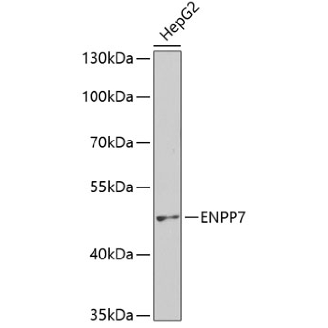 ENPP7 Rabbit Polyclonal Antibody