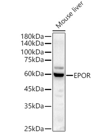 EPOR Rabbit Polyclonal Antibody