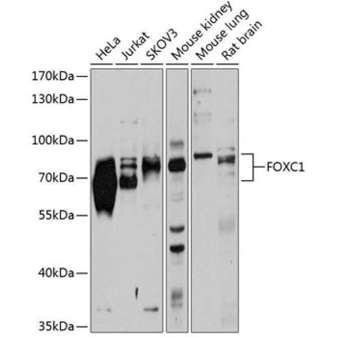 FOXC1 Rabbit Polyclonal Antibody