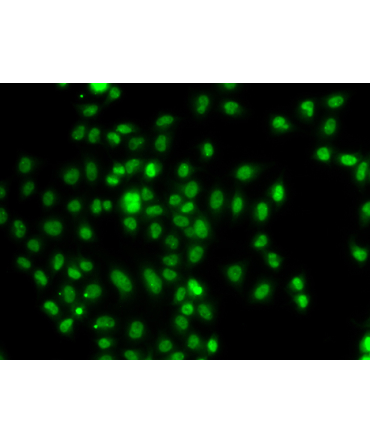 FOXN2 Rabbit Polyclonal Antibody