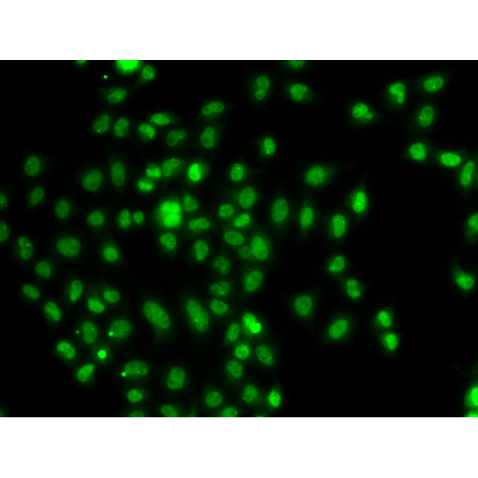 FOXN2 Rabbit Polyclonal Antibody
