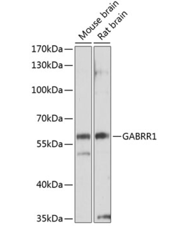 GABRR1 Rabbit Polyclonal Antibody