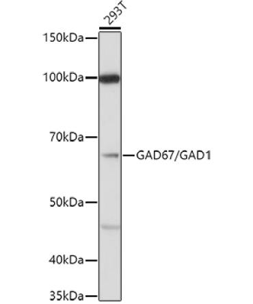 GAD67/GAD1 Rabbit Polyclonal Antibody
