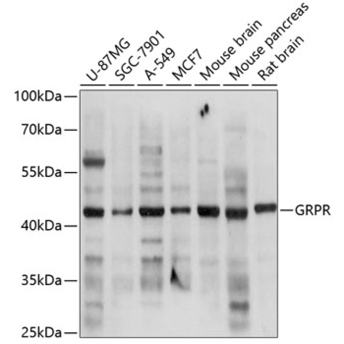 GRPR Rabbit Polyclonal Antibody