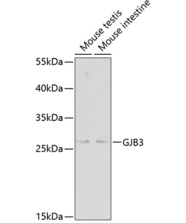 GJB3 Rabbit Polyclonal Antibody