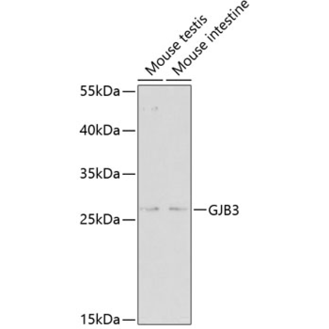 GJB3 Rabbit Polyclonal Antibody