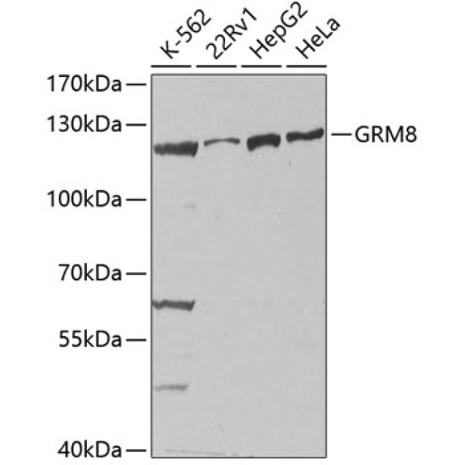 GRM8 Rabbit Polyclonal Antibody