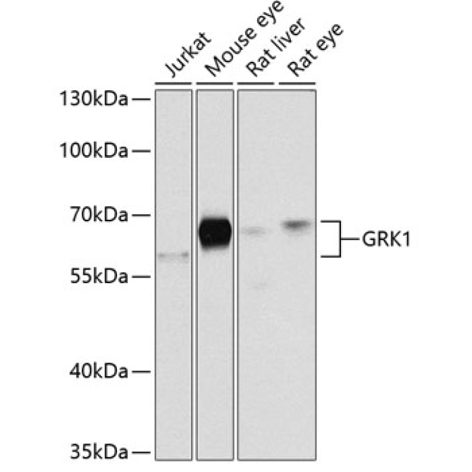 GRK1 Rabbit Polyclonal Antibody
