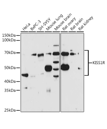 KISS1R Rabbit Polyclonal Antibody