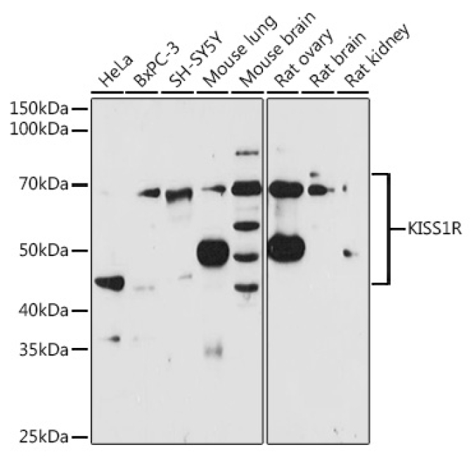KISS1R Rabbit Polyclonal Antibody