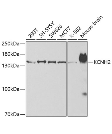 KCNH2 Rabbit Polyclonal Antibody