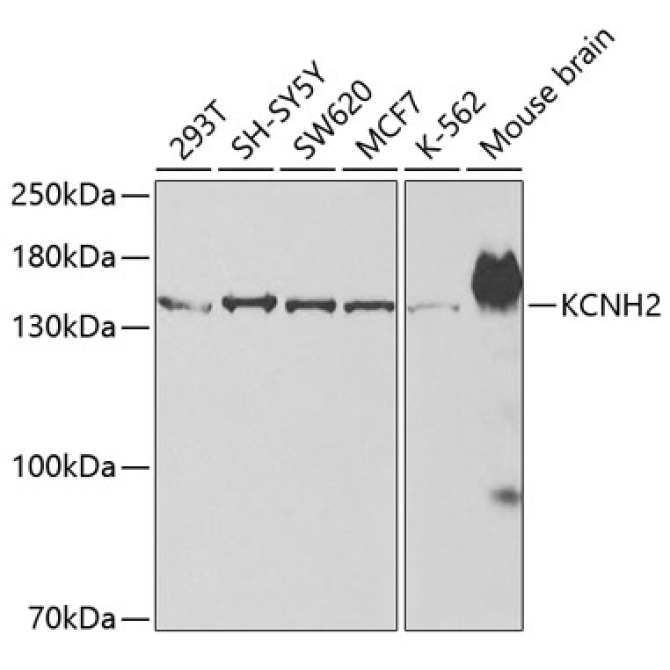 KCNH2 Rabbit Polyclonal Antibody