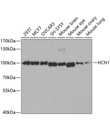 HCN1 Rabbit Polyclonal Antibody