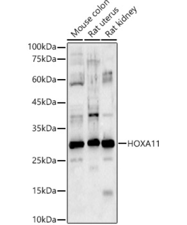 HOXA11 Rabbit Polyclonal Antibody