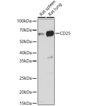 CD25 Rabbit Polyclonal Antibody