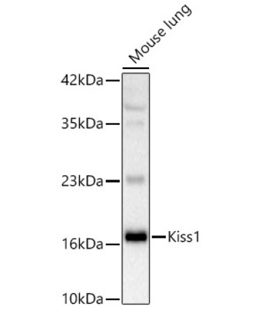 KISS1 Rabbit Polyclonal Antibody