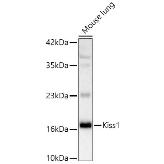KISS1 Rabbit Polyclonal Antibody