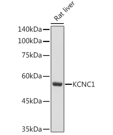 KCNC1 Rabbit Polyclonal Antibody