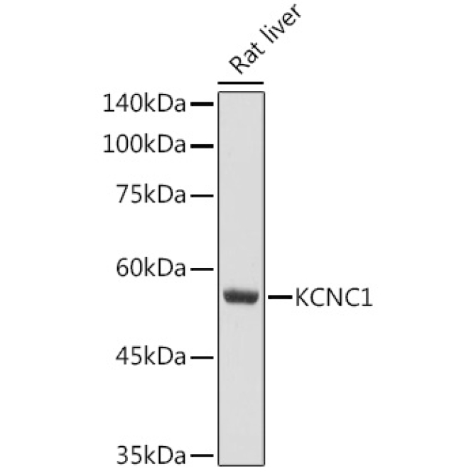 KCNC1 Rabbit Polyclonal Antibody