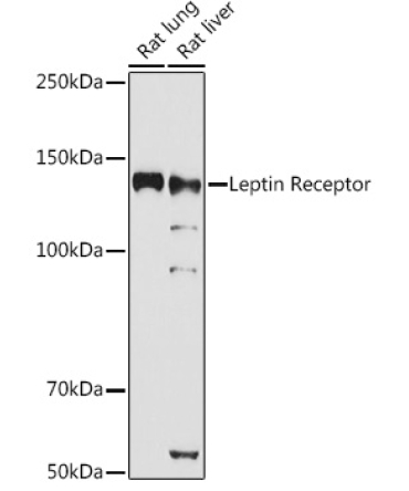 Leptin Receptor Rabbit Polyclonal Antibody