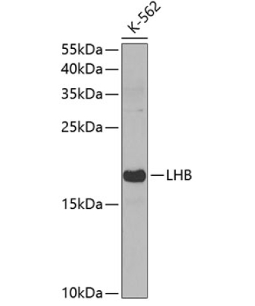 LHB Rabbit Polyclonal Antibody