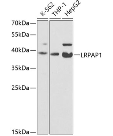 LRPAP1 Rabbit Polyclonal Antibody