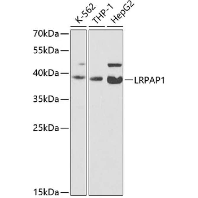 LRPAP1 Rabbit Polyclonal Antibody
