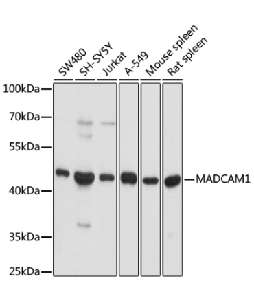 MADCAM1 Rabbit Polyclonal Antibody