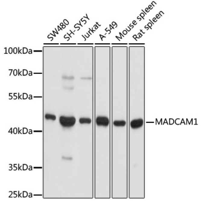 MADCAM1 Rabbit Polyclonal Antibody