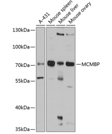 MCMBP Rabbit Polyclonal Antibody