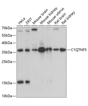 C1QTNF5 Rabbit Polyclonal Antibody