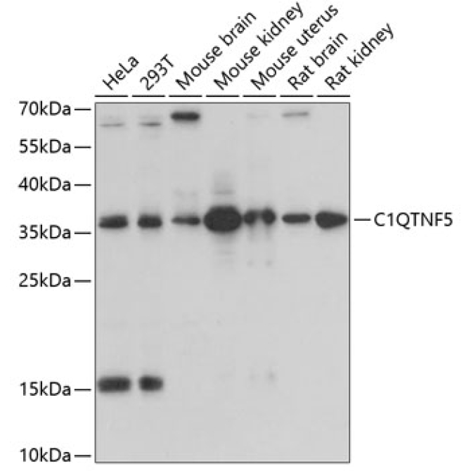 C1QTNF5 Rabbit Polyclonal Antibody