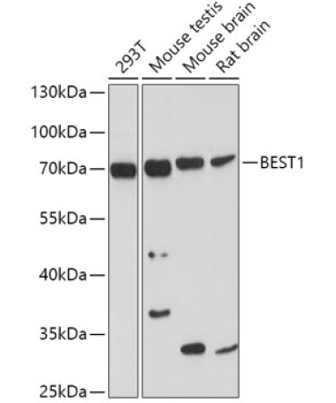 BEST1 Rabbit Polyclonal Antibody