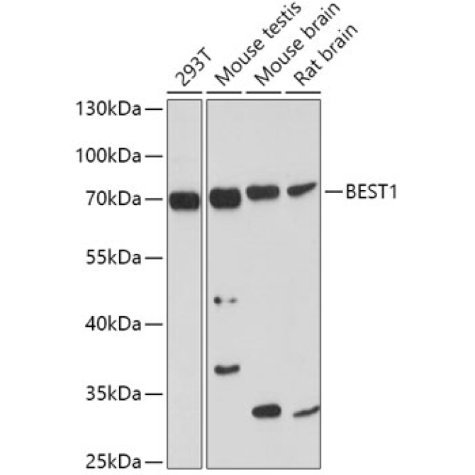 BEST1 Rabbit Polyclonal Antibody