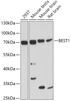 BEST1 Rabbit Polyclonal Antibody