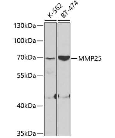 MMP25 Rabbit Polyclonal Antibody