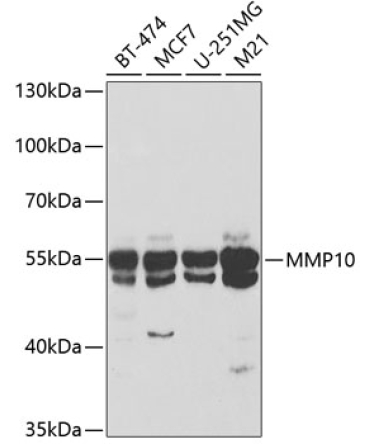 MMP10 Rabbit Polyclonal Antibody